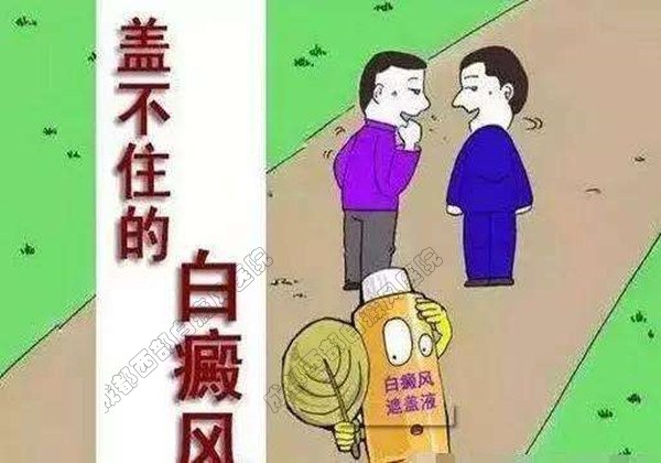 成都白癜风哪个医院好